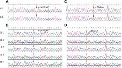 The same heterozygous Col4A4 mutation triggered different renal pathological changes in Chinese family members